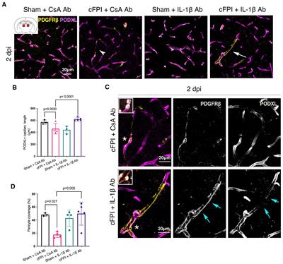 Neutralization of interleukin1-beta is associated with preservation of thalamiccapillaries after experimental traumatic brain injury